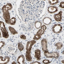 ethanolamine kinase Antibody, Novus Biologicals:Antibodies:Primary Antibodies